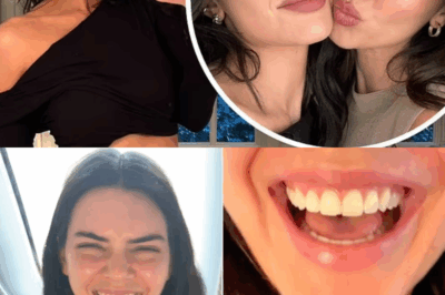 Kendall Jenner chipped one of her teeth while flying to watch the New York Knicks game with sister Kylie Jenner