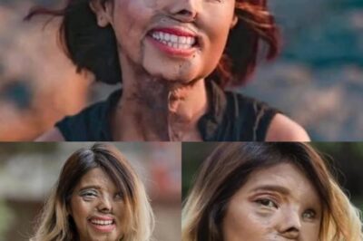 She Was Supposed to Die as a Baby—Today She Inspires the World. The Shocking Journey Everyone Needs to See