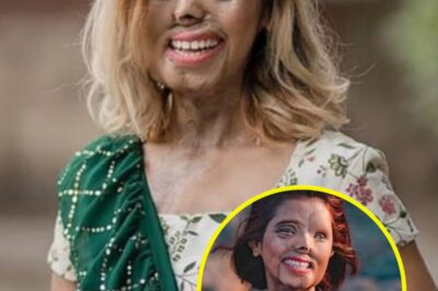 She Was Supposed to Die as a Baby—Today She Inspires the World.