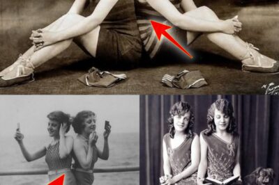 The Tragic Fame of Violet & Daisy Hilton: America’s Conjoined Twins Who Lived in the Spotlight and Shadow