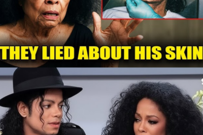Diana Ross Finally Reveals the Dark Truth Behind Michael Jackson’s Skin – It’s What Killed Him?